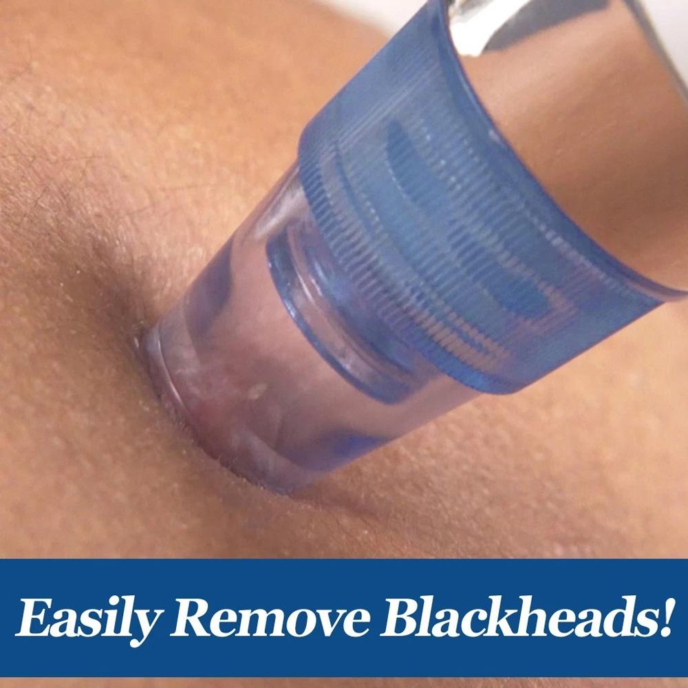 4 In 1 Blackhead Whitehead Extractor Remover Device